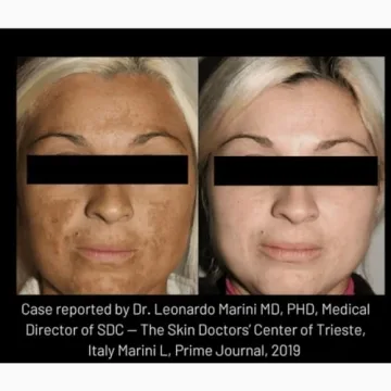 Cyspera Intensive Pigment Corrector - 1.75 Ounce