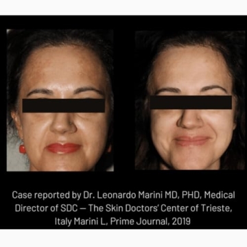 Cyspera Intensive Pigment Corrector - 1.75 Ounce