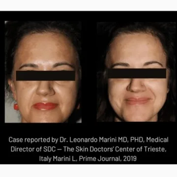 Cyspera Intensive Pigment Corrector - 1.75 Ounce