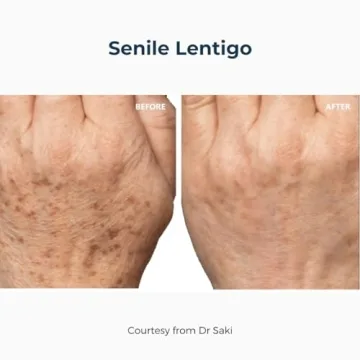 Cyspera Intensive Pigment Corrector - 1.75 Ounce