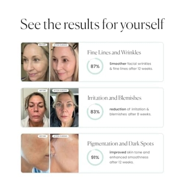 Qure LED Face Mask with 5 Light Modes for Home Use