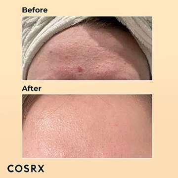 COSRX Skin Cycling Routine - Snail Mucin 96% Essence + Retinol 0.5 Oil, Recovery Set for Face and Neck, Fine Lines Spot Treatment, Repair Oil for Face