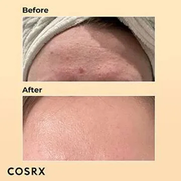 COSRX Skin Cycling Routine - Snail Mucin 96% Essence + Retinol 0.5 Oil, Recovery Set for Face and Neck, Fine Lines Spot Treatment, Repair Oil for Face