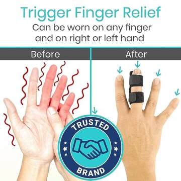 Vive Finger Splint (2 Pack) - Universal Finger Straightener - Broken and Trigger Finger Splints - Fi...