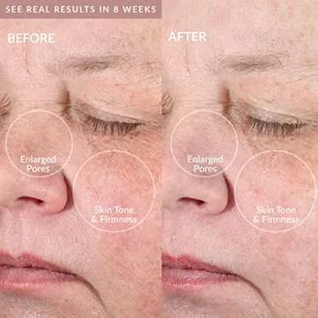 PMD Clean Pro Gold Smart Facial Cleansing Device for Radiant Skin