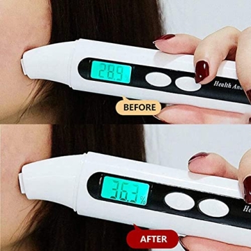 The Ordinary AHA 30% & BHA 2% Peeling Solution - Radiant Skin