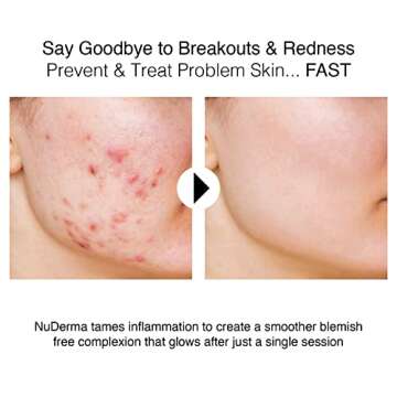 NuDerma Portable Handheld High Frequency Skin Therapy Wand Machine w/Neon – Anti-Aging - Skin Tightening - Wrinkle Reducing - Dark Circles – Clarifying - Hair & Scalp Stimulator