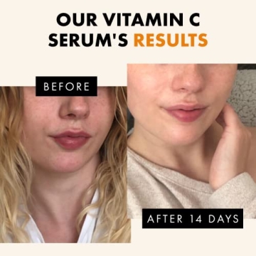 Radiance-Boosting Vitamin C Face Serum for Youthful Skin