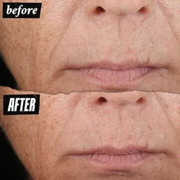 Kiehl's Midnight Recovery Concentrate Moisturizing Face Oil, Lightweight Facial Serum, Restores Skin Radiance Overnight, Reduces Fine Lines, Refines Skin Texture, 99.4% Naturally Derived - 3.4 fl oz