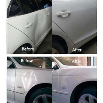 Hyamass 30Pcs Dent Removal Kit for Cars & Appliances