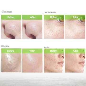 Blackhead Remover Mask | Charcoal Peel Off Face Mask