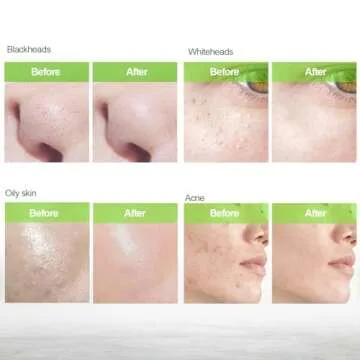 Blackhead Remover Mask | Charcoal Peel Off Face Mask