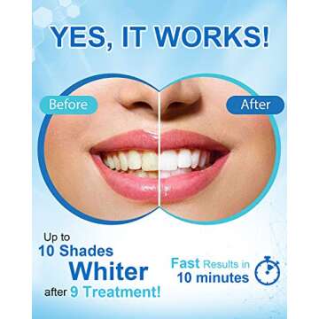 MySmile Teeth Whitening Pen - Fast, Effective, Non-Sensitive
