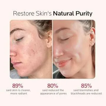 Facial Steamer Gift Kit: Deep Cleanse & Hydrate at Home