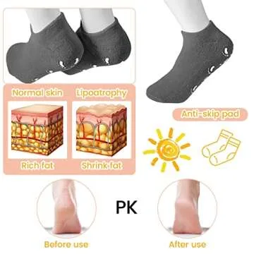 JaGely 6 Pairs Moisturizing Socks Soft Gel Spa Socks for Dry Cracked Feet Skins Gel Lined Feet Care Stocking for Repairing Softening Dry Cracked