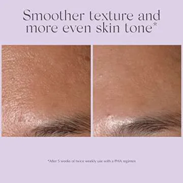 EXUVIANCE Performance Peel AP25 At-Home Chemical Peel with Glycolic, Mandelic and Polyhydroxy Acids, 13 ct.