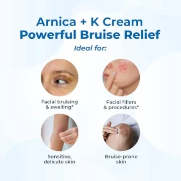 VitaMedica Arnica Cream for Bruises & Skin Recovery