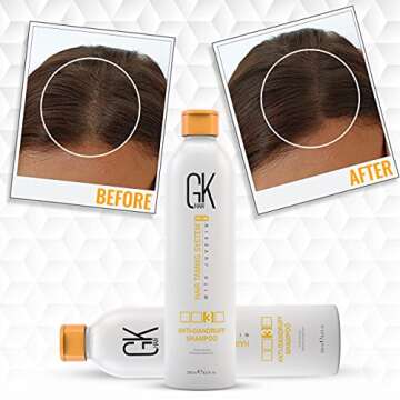GK HAIR Anti-Dandruff Shampoo for Men, Women & Kids – Natural, Flake Control & Scalp Care Shampoo (8.5 Fl Oz/250ml) Deep Cleansing, Impurities Remover, Sulfate-Free for Dry & Damaged Hair