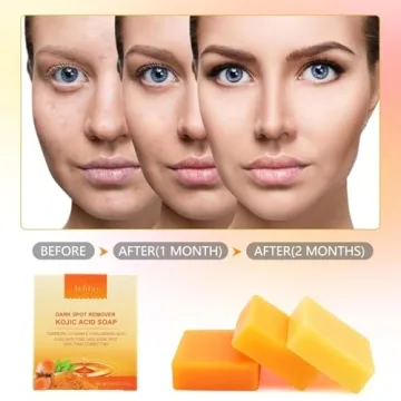 Inlifay Kojic Acid Turmeric Soap for Dark Spots & Brightening