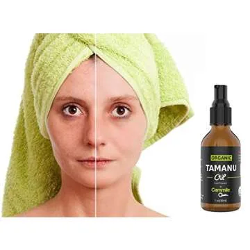 Cammile Q Organic Tamanu Oil - Natural Psoriasis Treatment - Great For Eczema, Acne & Scars - Cold Pressed