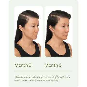 Divi Healthy Hair Bundle: Scalp Serum 1 fl oz and Hair Vitamins, 30-Day Supply