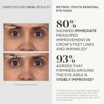 Murad Youth Renewal Eye Masks for Fine Lines and Puffiness