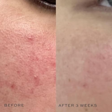 DIME Beauty Super Skin Toner Hydrating Witch Hazel Formula