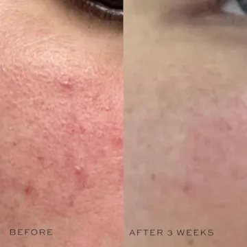 DIME Beauty Super Skin Toner Hydrating Witch Hazel Formula