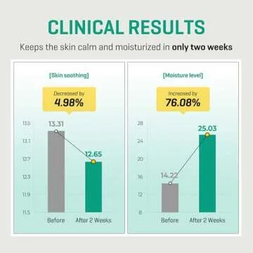 SOME BY MI AHA BHA PHA 30 Days Miracle Serum Light - 1.69oz, 50ml - Daliy Exfoliating Salicylic Acid Serum for Pore and Blackhead Care - Centella & Niacinamide for Skin Soothing - Korean Skin Care