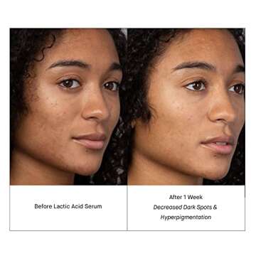 SHANI DARDEN SkinCare Lactic Acid Serum for Glowing Skin, 0.34 fl oz