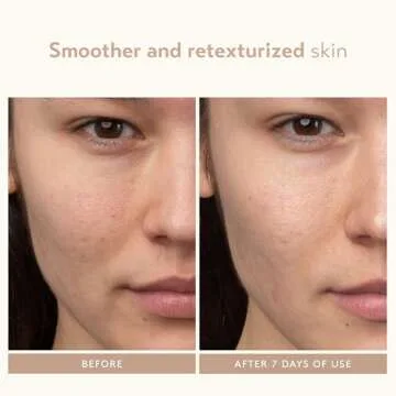 Shani Darden Lactic Acid Night Serum for Radiant Skin