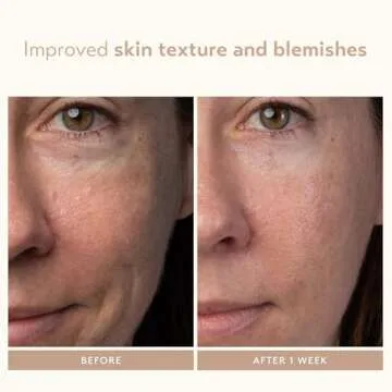 Shani Darden Lactic Acid Night Serum for Radiant Skin