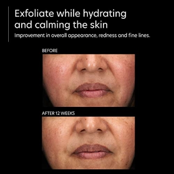 PCA SKIN Resurfacing Serum for Smoother Brighter Skin