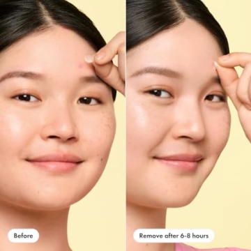 Hero Cosmetics Mighty Patch Mini Invisible Acne Patches 30ct