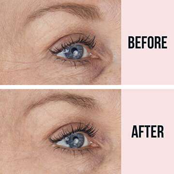 SiO Beauty Eye & Smile Anti-Wrinkle Patches - 2 Week Supply, Overnight Smoothing Silicone for Fine L...