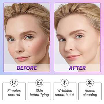 Beauty Star Portable Violet Wand Device for Women/Men Use