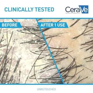 CeraVe Anti Dandruff Shampoo 12 Oz - Flake Control & Hydration