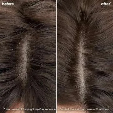 BIOLAGE Scalp Sync Purifying Scalp Concentrate - Exfoliates & Clarifies Scalp Buildup, Paraben & Silicone-Free, Vegan