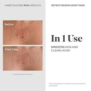 Murad Acne Retexturizing Face & Body Pads - Smooth + Soothe - with Azelaic + Bacteria-Targeting Multi-Acids to Soothe Irritation, Redness, and Providing Oil-Free Hydration, 45Pc