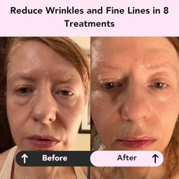 Glorio RENEW 8 Collagen Boosting Clay Mask Treatments