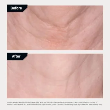 Nectifirm Anti-Aging Cream for Neck and Décolleté 1.7 oz