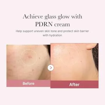 medicube Salmon DNA PDRN Pink Hyaluronic Moisturizing Cream, Pink Soothing Cream, Hyaluronic acid, Niacinamide, Hydrating & Firming, Uneven Skin Tone, Pore Care, Korean Skincare | (50ml/ 1.69 fl.oz.)