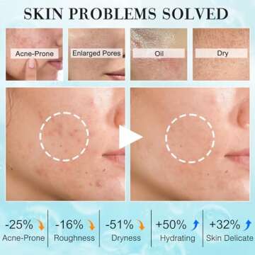 Teen Woman Gifts,Skin Care,Skincare,Hydrate,Oil Control,Pore Shrinking,Anti-Allergy Facial Skin Care...