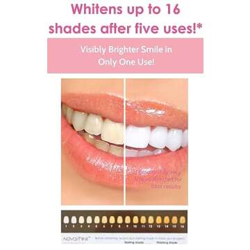 Novashine Professional Teeth Whitening Kit: LED Light & Peroxide Gel, Smartphone Adapter