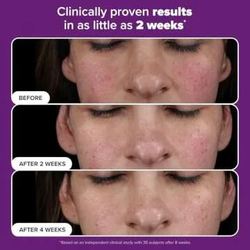 Paula’s Choice Pro Retinaldehyde Dual-Retinoid Advanced Treatment, High Potency Anti-Aging Serum for Breakout-Prone Skin, Radiance & Rough, Bumpy Texture, Fragrance-Free, 1 Fl. Oz.