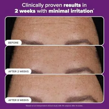 Paula’s Choice Pro Retinaldehyde Dual-Retinoid Advanced Treatment, High Potency Anti-Aging Serum for Breakout-Prone Skin, Radiance & Rough, Bumpy Texture, Fragrance-Free, 1 Fl. Oz.