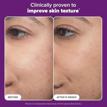 Paula’s Choice Pro Retinaldehyde Dual-Retinoid Advanced Treatment, High Potency Anti-Aging Serum for Breakout-Prone Skin, Radiance & Rough, Bumpy Texture, Fragrance-Free, 1 Fl. Oz.