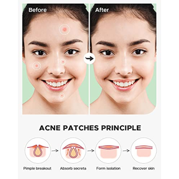 ZATKTK Acne Pimple Patch 180 Count with Natural Oils