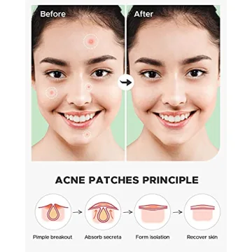 ZATKTK Acne Pimple Patch 180 Count with Natural Oils