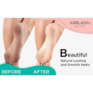 Best Callus Remover Gel with Pumice Stone Scrubber for Feet